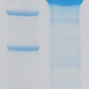 Recombinant Human NF-L Protein