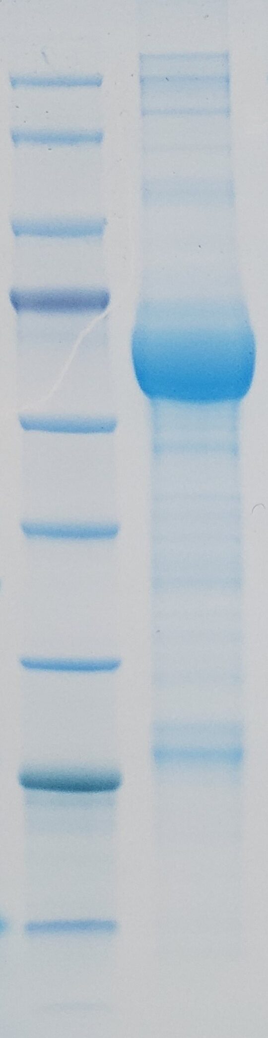 Recombinant Human NF-L Protein
